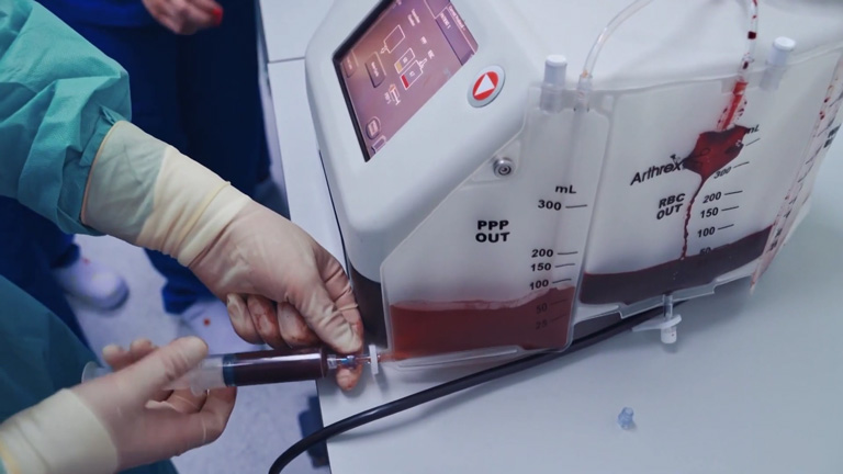 ¿Qué es el plasma convaleciente?